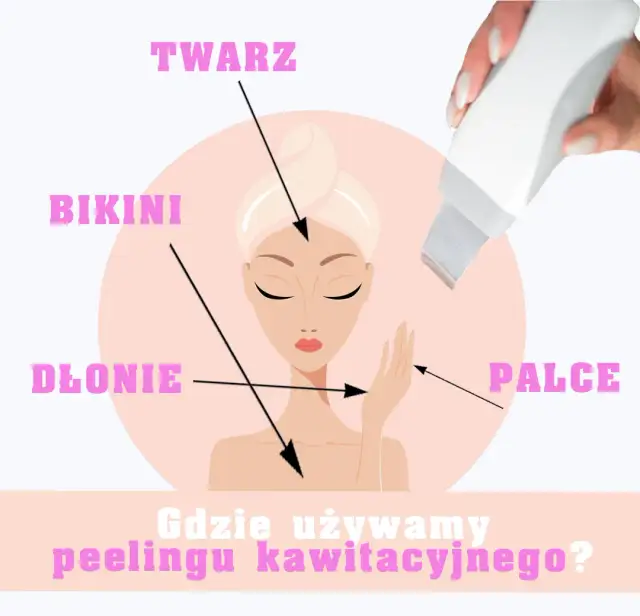 Peeling kawitacyjny na czym polega i jakie przynosi korzyści