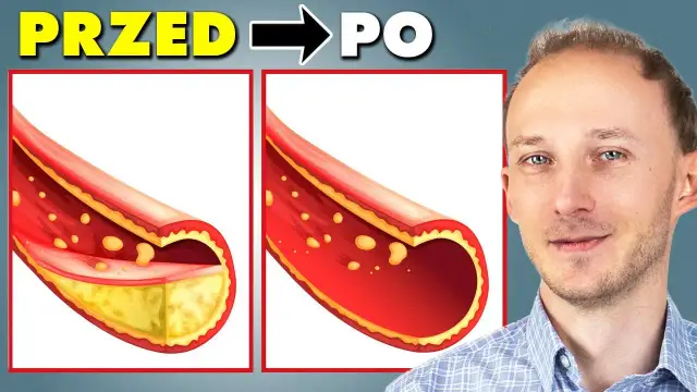 Czy żyły się regenerują? Odkryj tajemnice zdrowych naczyń krwionośnych