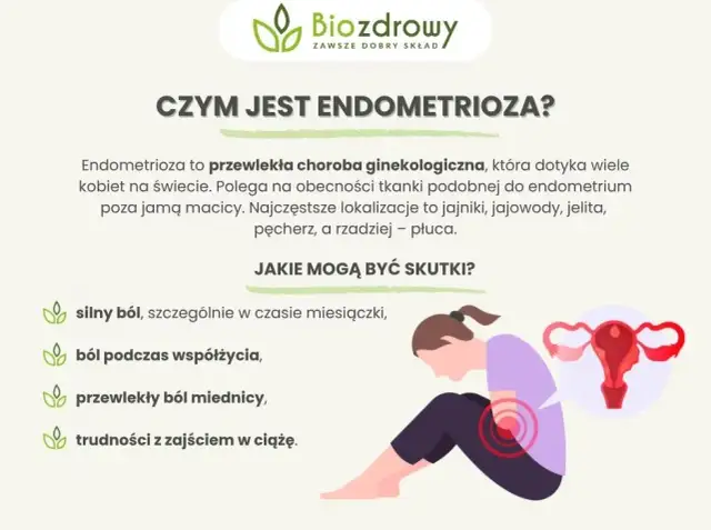 Endometrioza: Jakie leki? Skutki, płodność i nowe terapie w PL