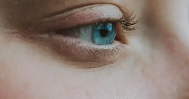 Jaki krem do cery naczynkowej? Wybierz najlepszy i pożegnaj rumień