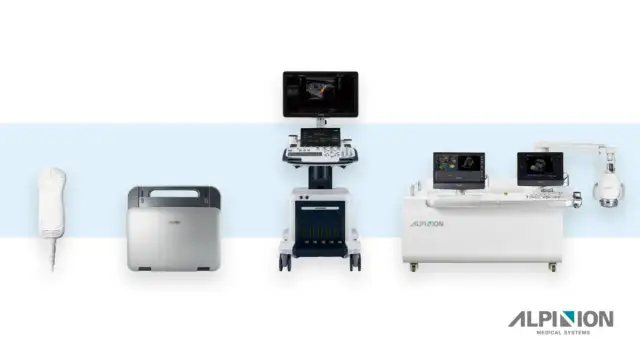 Ile kosztuje aparat? Przewodnik po cenach i budżecie