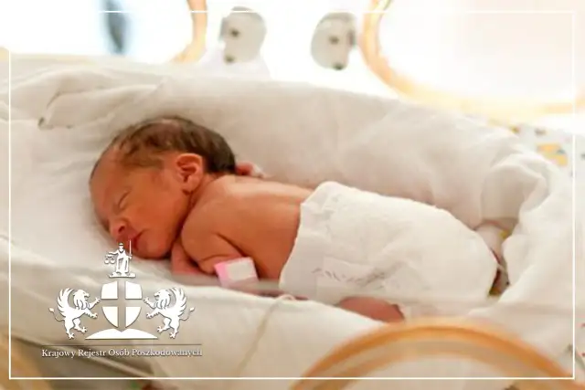 Odszkodowanie za złamany obojczyk u dziecka: Jak uzyskać maks. kwotę?