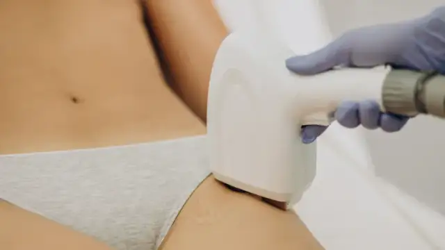 Jak przygotować się do depilacji laserowej bikini, aby uniknąć bólu i podrażnień