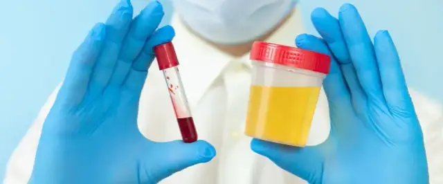 Leki na krwiomocz: skuteczne sposoby leczenia i przyczyny