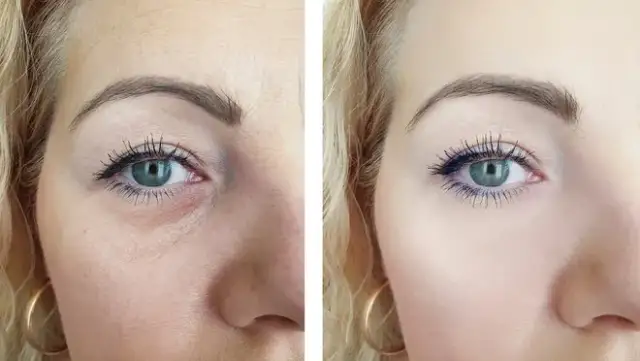 Wypadły Ci rzęsy? Sprawdź, czy odrosną i jak je wzmocnić!