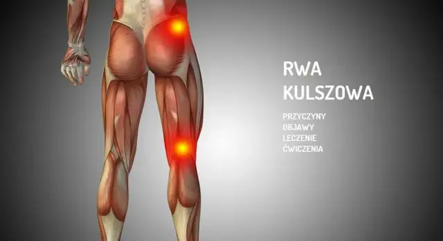 Rwa kulszowa a ból kolana: objawy, które musisz znać