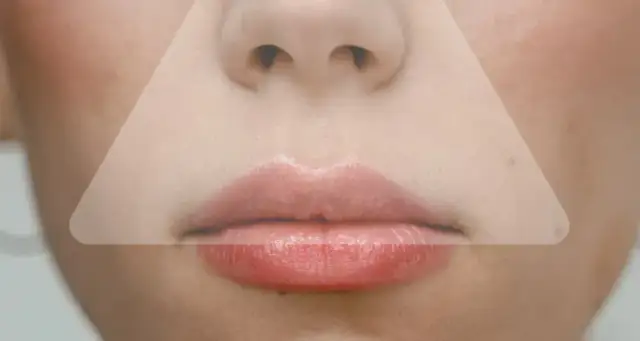 Wycisnęłaś pryszcza? Szybka pomoc, by uniknąć blizn i zaczerwienień!