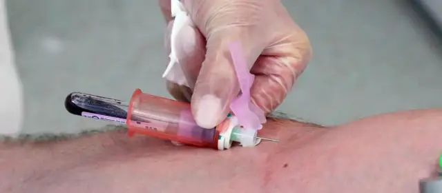 Czy badanie krwi wykryje tabletki poronne? Prawda, która zaskakuje