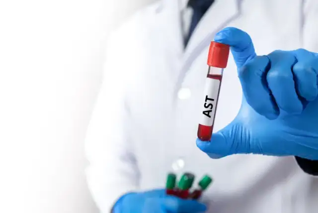 Badanie AST: Co oznacza wynik? Normy, przyczyny, interpretacja