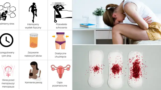 Kiedy miesiączka po stymulacji? Oczekiwania i rzeczywistość menstruacji
