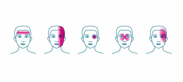 Napięciowe bóle głowy objawy: jak je rozpoznać i złagodzić ból