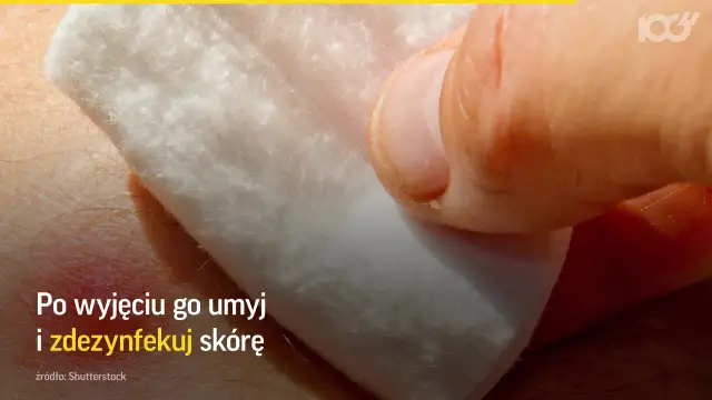 Jak wygląda kleszcz? Rozpoznaj go i chroń zdrowie!