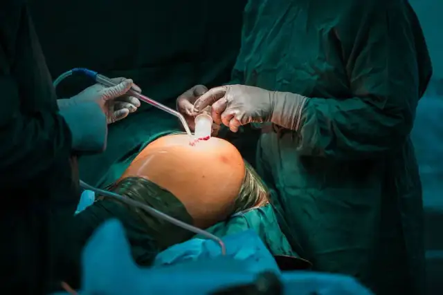 Czy po endoprotezie biodra przysługuje renta? Sprawdź swoje prawa