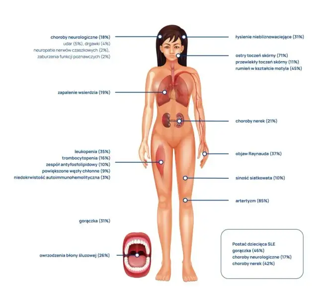 Jakie badania zrobić przy toczniu? Kluczowe testy diagnostyczne