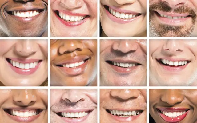 Czy usuwanie kamienia jest na NFZ? Sprawdź, co musisz wiedzieć