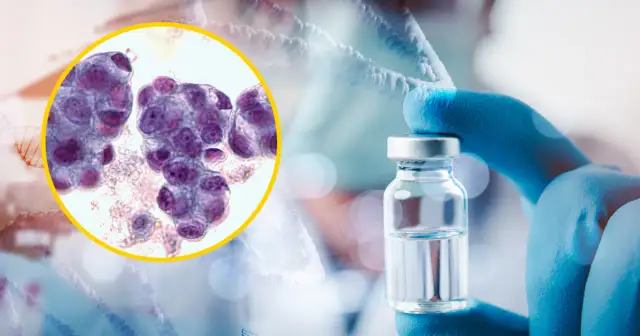 Czy jest skuteczny lek na raka? Odkryj prawdę o terapiach i nadziei