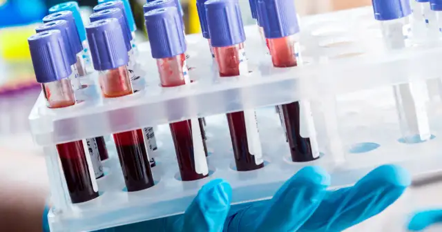 Diagnosta laboratoryjny i inni: Kto odpowiada za Twoje wyniki?