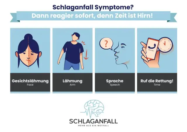 Hirnschlag Symptome: So erkennen Sie die alarmierenden Anzeichen