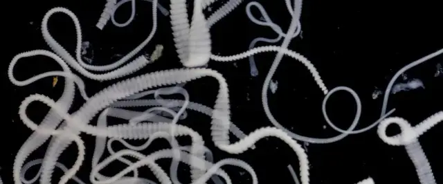 Tasiemiec psi u człowieka: 5 objawów których nie przegap