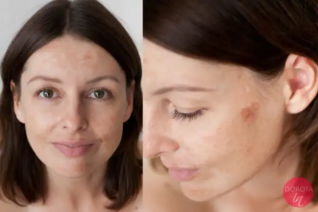 Skuteczny kamuflaż pryszczy: Jak ukryć niedoskonałości makijażem?