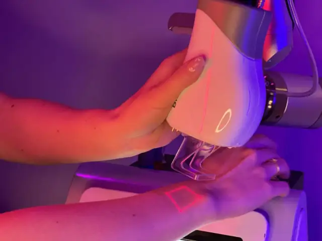 Kiedy najlepiej zrobić laser frakcyjny, aby uniknąć powikłań?