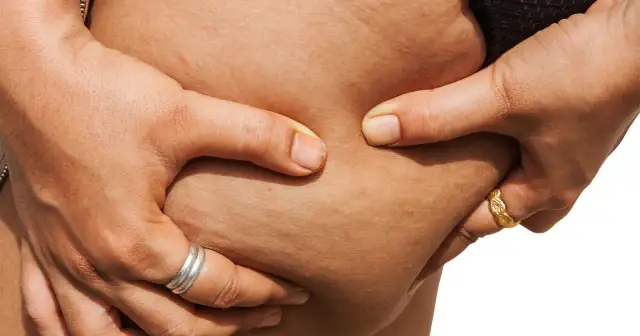 Cellulit na udach? Skuteczny plan na gładką skórę!