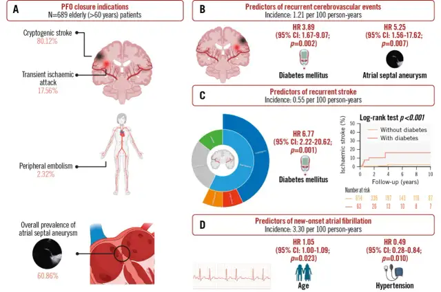 PFO closure indications: 80% kryptogenny udar, 17% TIA. Obraz przedstawia objawy neurologiczne i czynniki ryzyka udaru.
