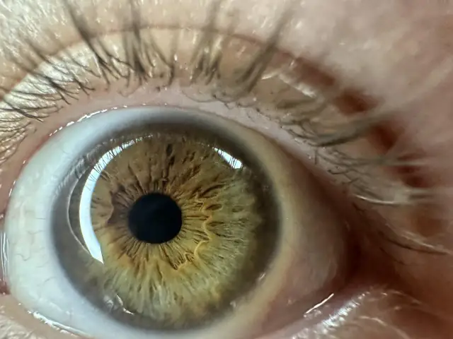 Jak zrobić zdjęcie oka telefonem? Odkryj sekrety makro.