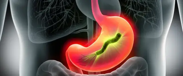 Objawy H. pylori w jamie ustnej: co mówi Twój oddech i język?