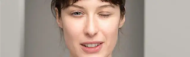 Miastenia - co to za choroba, objawy, przyczyny i skuteczne leczenie