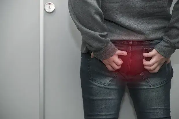 Skuteczne metody na ból odbytu – jak leczyć i uniknąć cierpienia