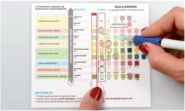 Czy badanie moczu wykryje zapalenie pęcherza? Kluczowe informacje o diagnostyce