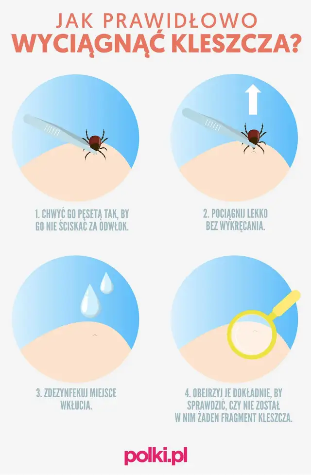 Co zrobić po wyciągnięciu kleszcza? Kluczowe kroki, aby uniknąć problemów