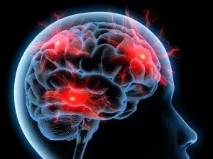 Objawy zaburzeń układu nerwowego – jak rozpoznać problemy neurologiczne?