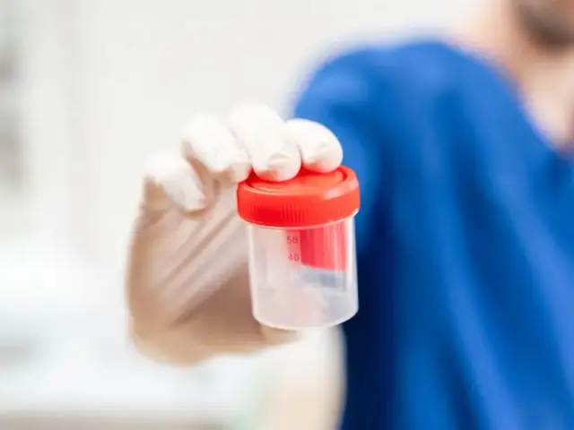 Jak się przygotować do badania nasienia, aby uniknąć błędów?