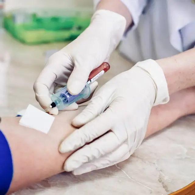 Czy badania krwi wykryją raka? Fakty i ograniczenia diagnostyki