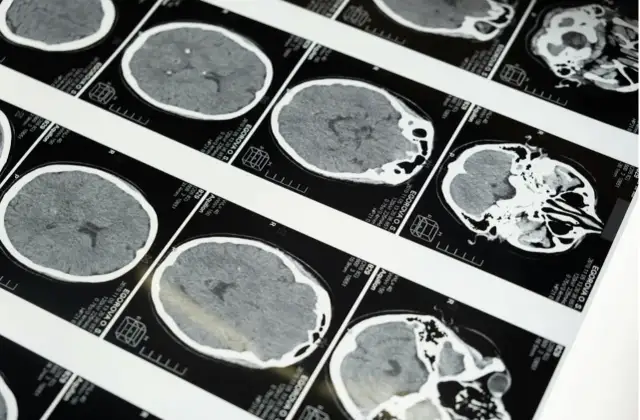 Teleradiologia – jak działa i dlaczego coraz częściej zastępuje tradycyjne opisy badań?