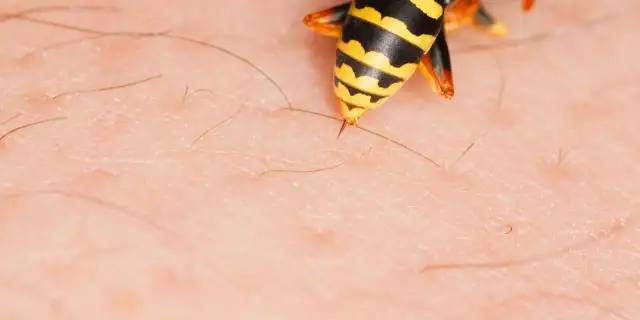 Skutki uboczne odczulania na jad osy: jakie reakcje mogą wystąpić?