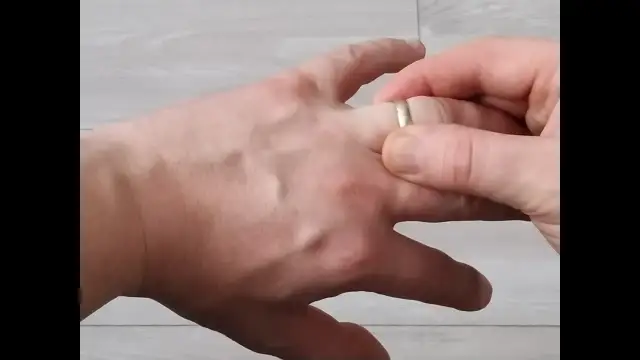 Jak zdjąć obrączkę: 5 skutecznych sposobów na ciasny pierścionek