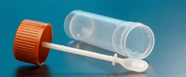 Ile kosztuje badanie na pasożyty? Ceny w miastach Polski i porady