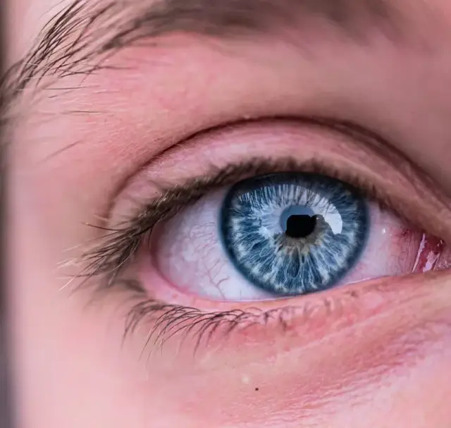 Jakie soczewki na suche oczy? Najlepsze opcje dla komfortu i zdrowia