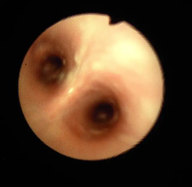 COPD u koni: objawy, leczenie i profilaktyka RAO w hodowli