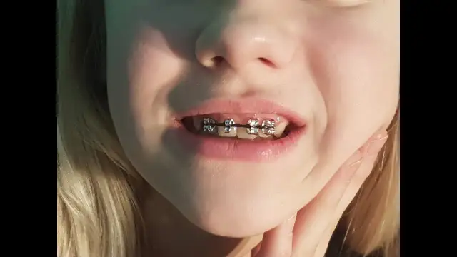 Czy można bezpiecznie zrobić sztuczny aparat na zęby w domu? Ryzyka i alternatywy