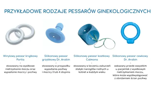 Pessar - jakie są koszty i zastosowanie w leczeniu ginekologicznym