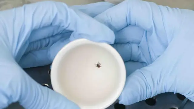 Czy badanie na boreliozę jest płatne? Koszty i refundacja NFZ