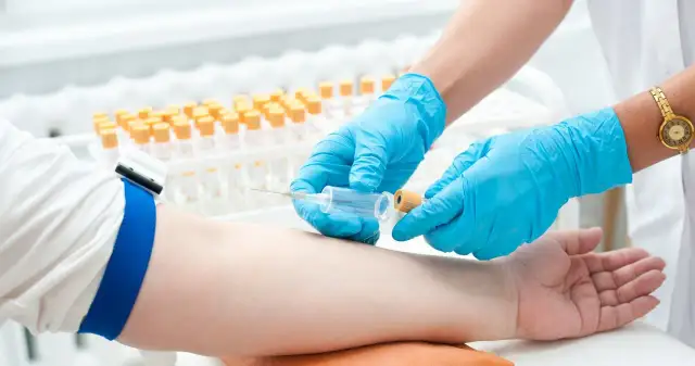 Czy można pić przed badaniem krwi? Ważne zasady, które musisz znać