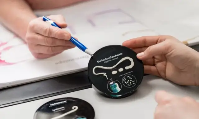 Tasiemiec czym się żywi – co zagraża Twojemu zdrowiu?