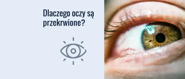Dlaczego konie mają zasłonięte oczy? Powody, korzyści i zastosowanie klapek