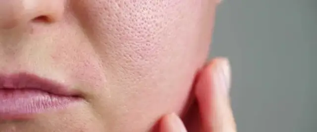 Cera tłusta: 7 rzeczy, których musisz unikać - skuteczna pielęgnacja