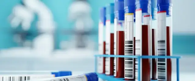 Jaki cholesterol jest niebezpieczny i jak uniknąć zagrożeń zdrowotnych